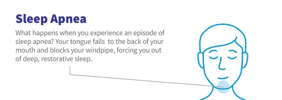 _wp_attachment_image_alt