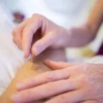 acupuncture 5126777_1920